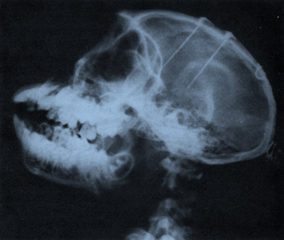 An X-ray of a monkey’s head in which neuroscientist Jose Delgado implanted electrodes arrays in the frontal lobes and the thalamus. Image: Physical Control of the Mind by Jose Delgado.